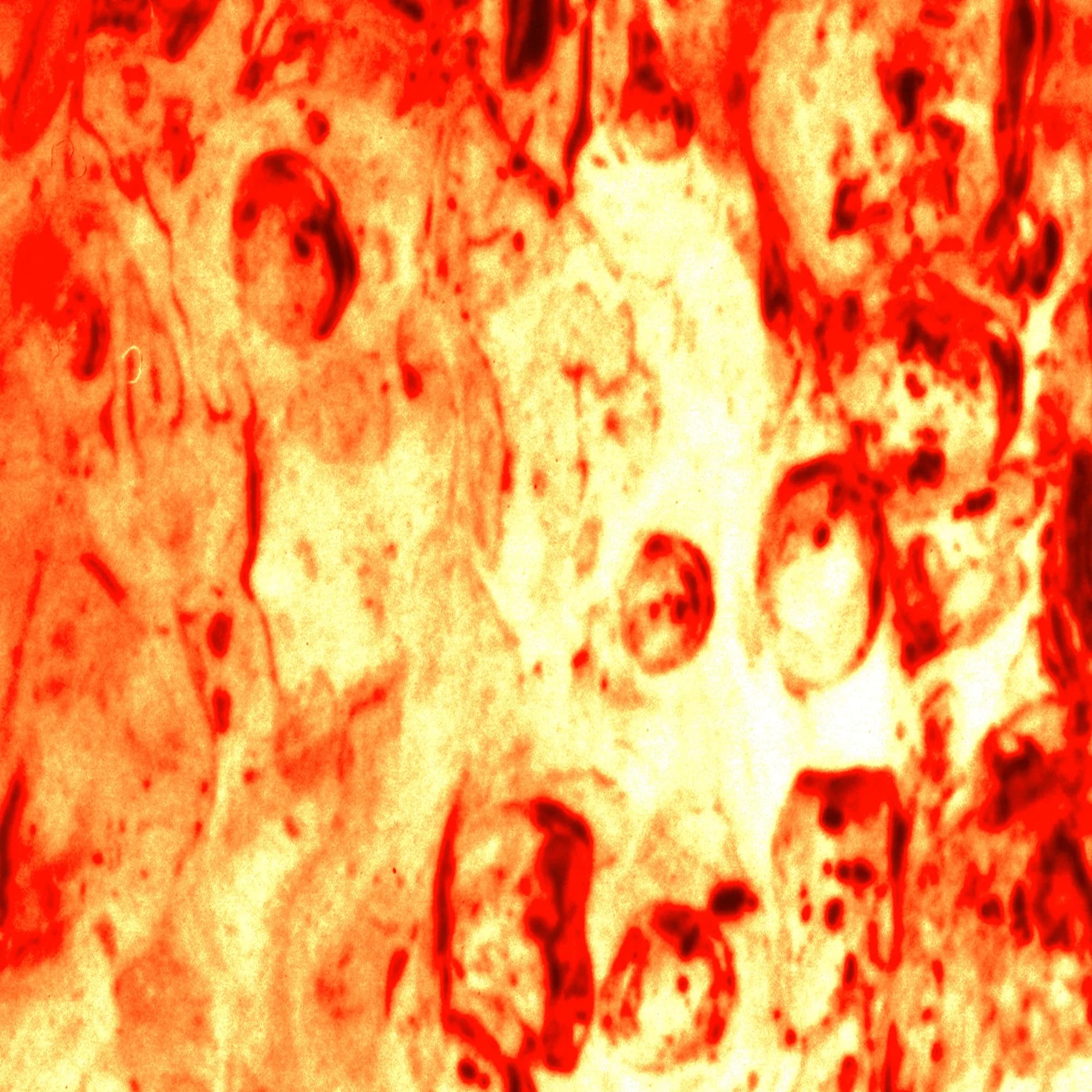 Solar Fold, detail at actual size